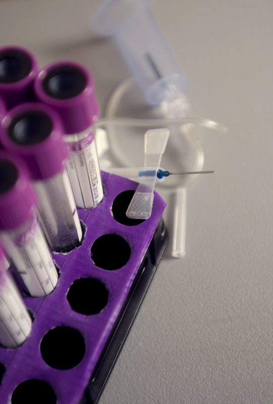 È possibile diagnosticare precocemente il cancro con un semplice esame del sangue? Dottore, ma