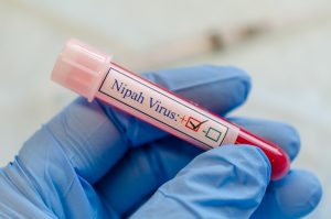 Il virus Nipah potrebbe causare una nuova pandemia?