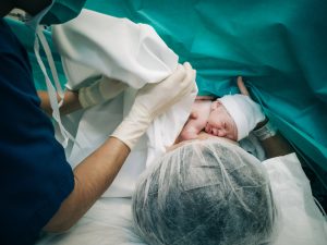 il parto cesareo è più sicuro di quello naturale?