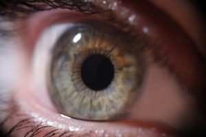 occhio I difetti visivi si possono curare con la chirurgia?