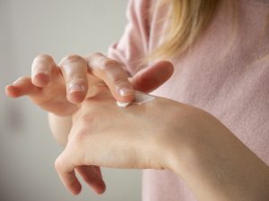 le punture di insetto possono essere pericolose after bite pomata antistaminica