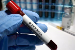 C’è un’epidemia di gonorrea?