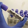 Provetta di laboratorio etichettata “Nipah virus” durante analisi diagnostiche per identificare l’infezione.