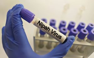 Provetta di laboratorio etichettata “Nipah virus” durante analisi diagnostiche per identificare l’infezione.