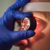 Visita oculistica specialistica per infiammazione dell’occhio associata a uveite virale.