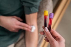 Provette contenenti campioni di sangue in primo piano durante un prelievo, immagine riferita alla ricerca di biomarcatori per la diagnosi della depressione.