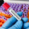 Provette di laboratorio con campione identificato come Yersinia pestis