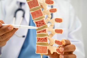 Medico indica le vertebre su un modello anatomico per spiegare la salute delle ossa